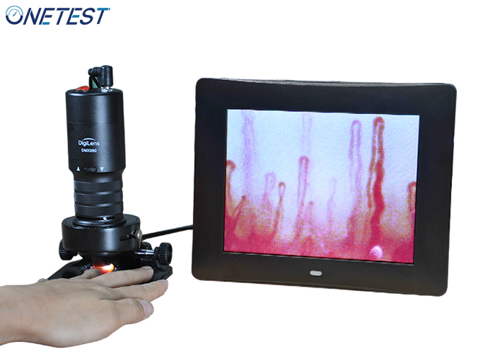 微循環(huán)血液檢測(cè)儀特點(diǎn)與應(yīng)用是哪些